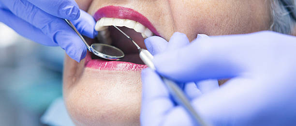 Best Emergency Dental Services for Seniors in Bear Creek, FL